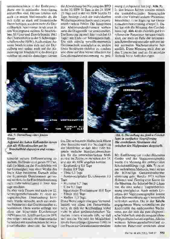 Vorschauseite 3: Erweiterte Biometrie am Feten