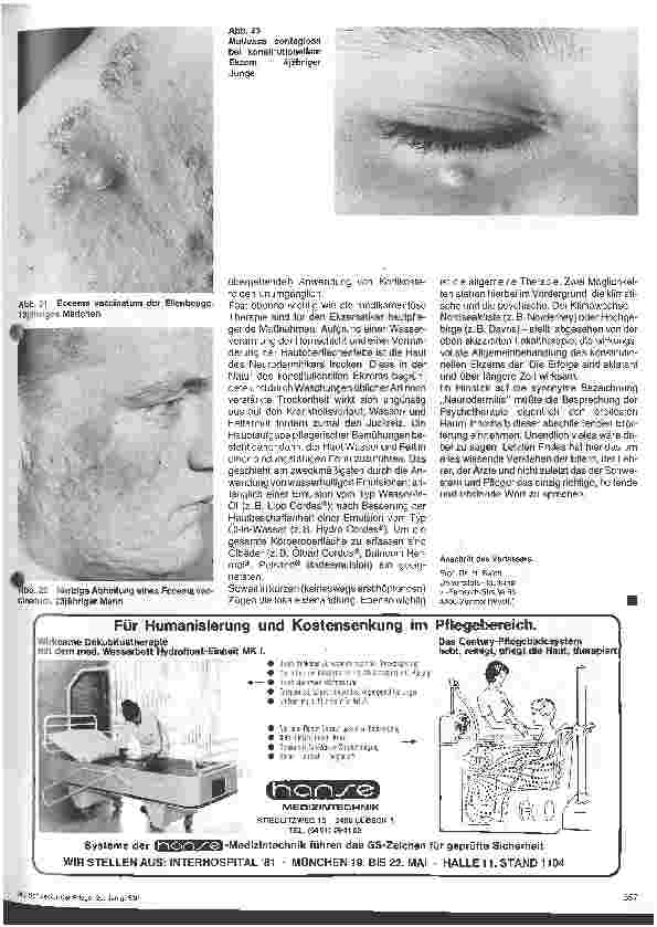 Vorschauseite 5: Hautärztliche Blick-Diagnose von Erbkrankheiten: Das konstitutionelle Ekzem