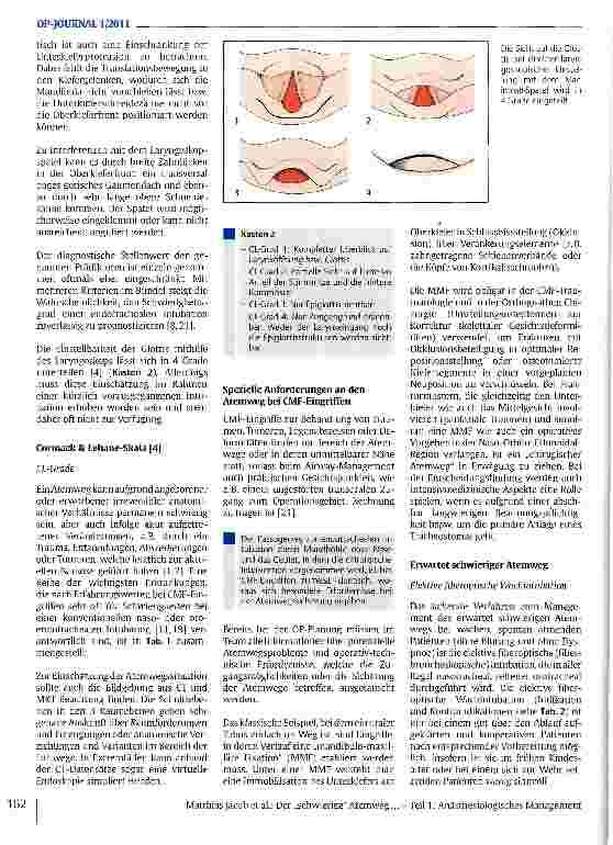Vorschauseite 3: Der „schwierige Atemweg bei kranio-maxillo-fazialen Eingriffen