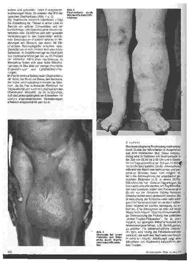 Vorschauseite 3: Wurminfektionen - Filariasis (I)