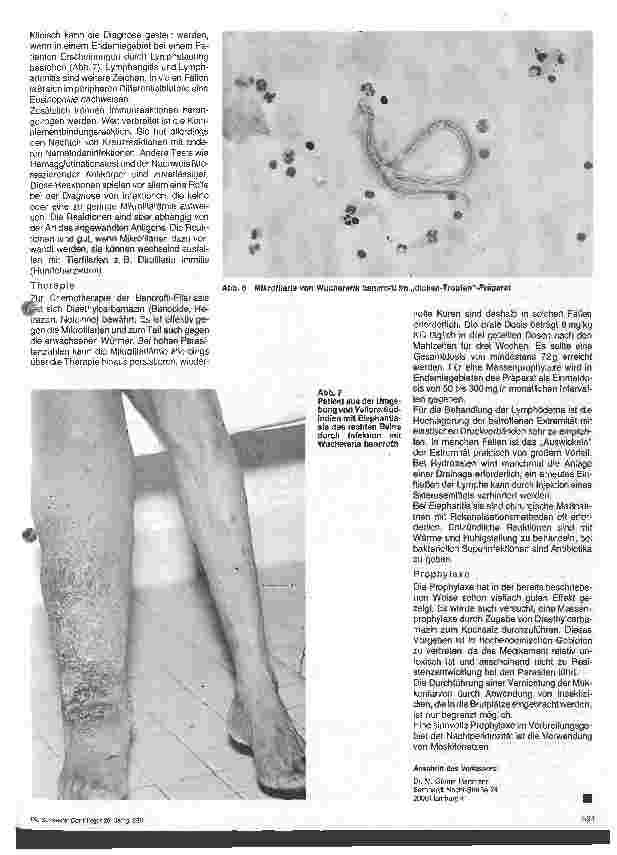 Vorschauseite 4: Wurminfektionen - Filariasis (I)