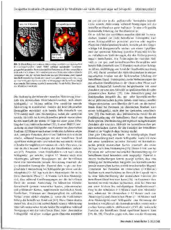 Vorschauseite 3: Die repetitive transkranielle Magnetstimulation in der Rehabilitation von Handfunktionsstörungen nach Schlaganfall