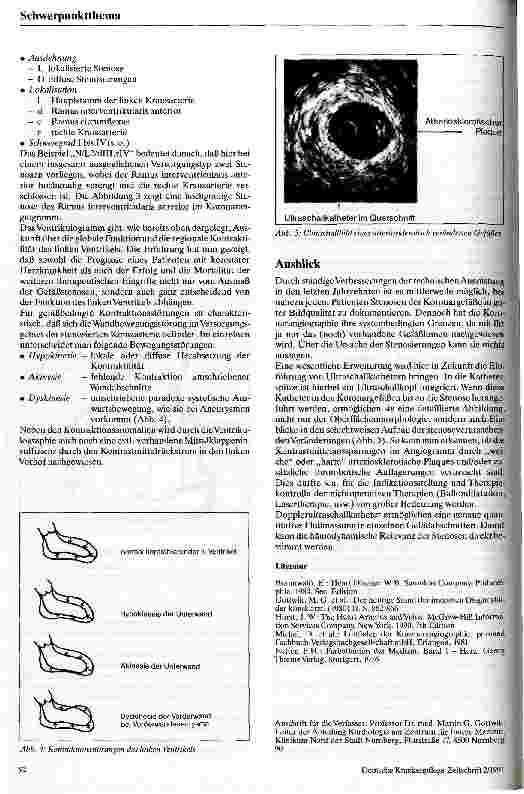 Vorschauseite 4: Die invasive Diagnostik der koronaren Herzkrankheit