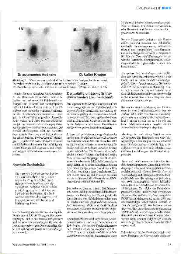 Vorschauseite 2: Erkrankungen der Schilddrüse
