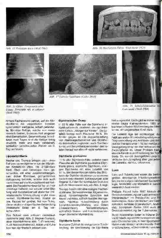 Vorschauseite 3: Pädiatrische Krankheitsbilder aus früherer Zeit