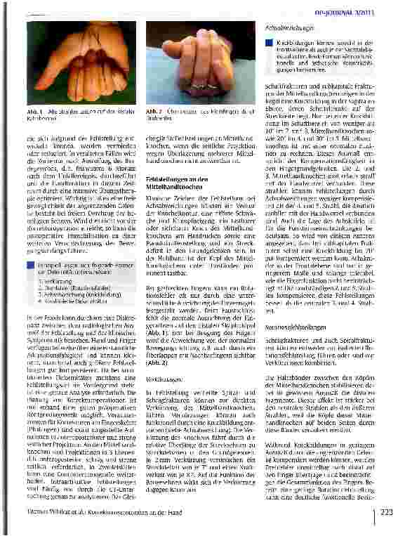 Vorschauseite 2: Korrekturosteotomien an der Hand