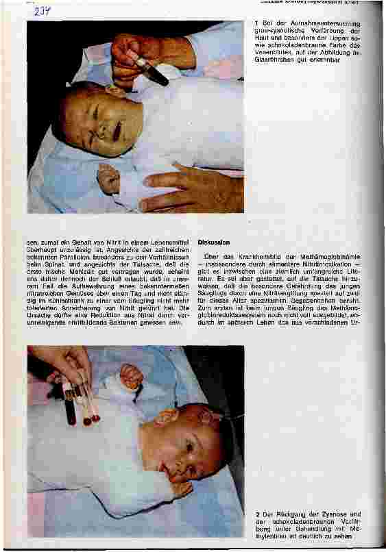 Vorschauseite 2: Methämoglobinämie bei einem Säugling infolge Nitritvergiftung durch Kohlrabimahlzeit