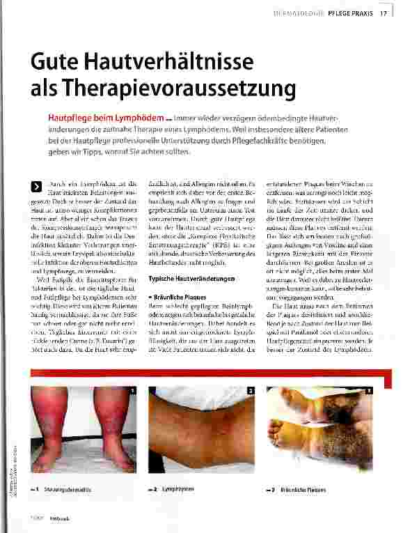 Vorschauseite 1: Gute Hautverhältnisse als Therapievoraussetzung