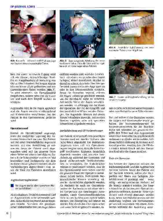Vorschauseite 3: Perioperative Patientenbetreuung bei „kranio-maxillo-fazialen EingriffenDisposition, Planung und Ausführung