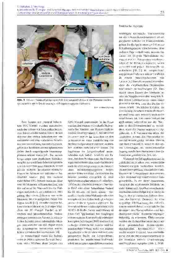 Vorschauseite 4: Konventionelle Therapie und Leberzelltherapie bei neonataler Manifestation eines Harnstoffzyklusdefektes