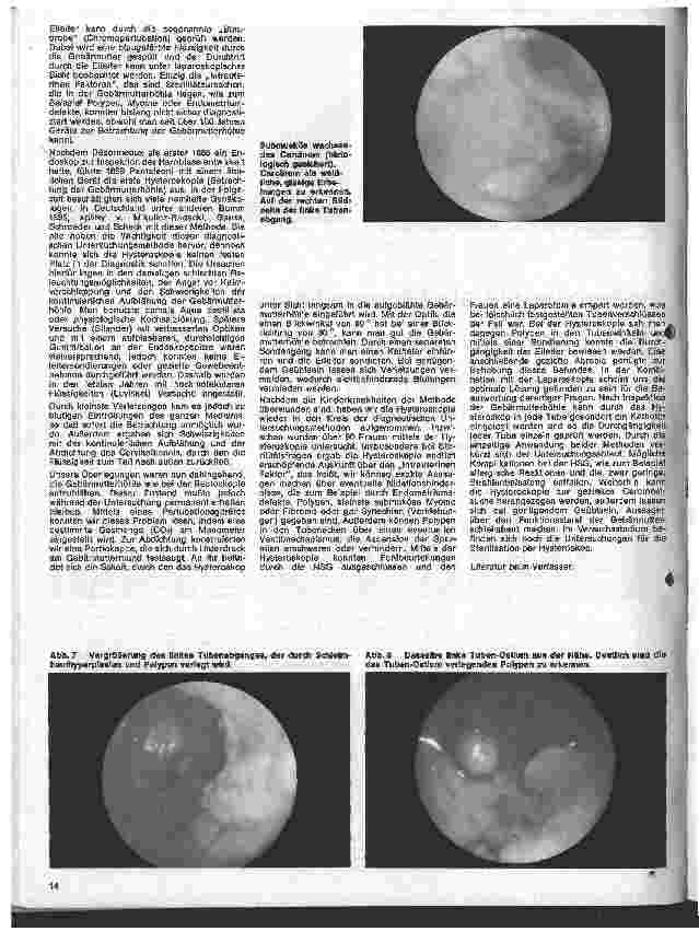 Vorschauseite 2: Hysteroskopie als Diagnostikum bei gynakologischen Erkrankungen