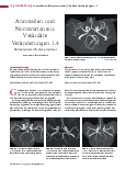 Vorschauseite 1: Anomalien und Normvarianten: Vaskuläre Veränderungen 1.4 Varianten des Circulus arteriosus