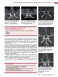 Vorschauseite 2: Anomalien und Normvarianten: Vaskuläre Veränderungen 1.4 Varianten des Circulus arteriosus