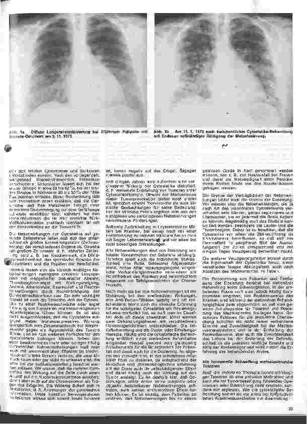 Vorschauseite 2: Radiologie // Eine Einführung für Krankenschwestern u. Krankenpfleger 6. Folge: Möglichkeiten u. Grenzen der Zusatztherapie des Krebses