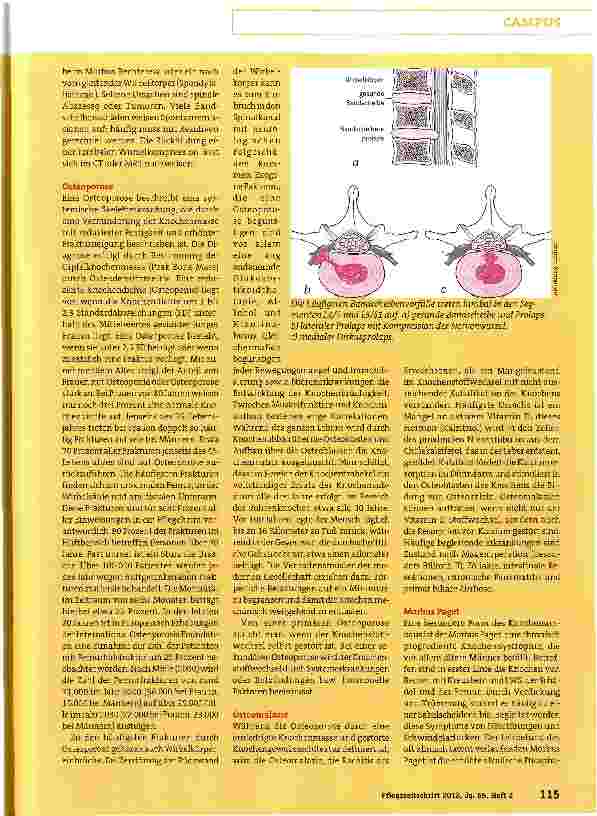 Vorschauseite 2: Von der Osteoporose bis zum Tumor