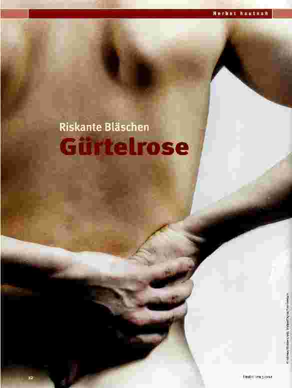 Vorschauseite 1: Riskante Bläschen Gürtelrose