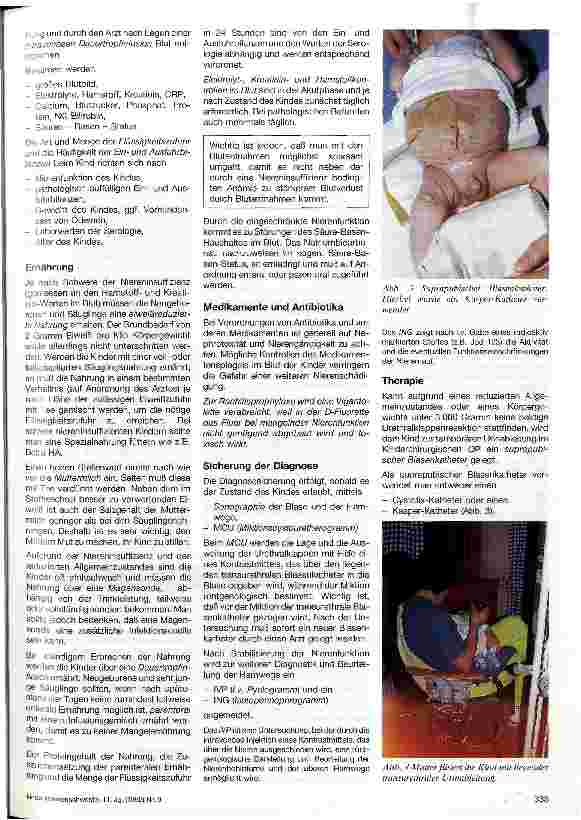 Vorschauseite 2: Präund postoperative Pflege von männlichen Neugeborenen und Säuglingen mit Urethralklappen