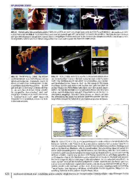 Vorschauseite 3: Geschichte und technische Möglichkeiten der winkelstabilen Osteosynthese - eine Bildergeschichte