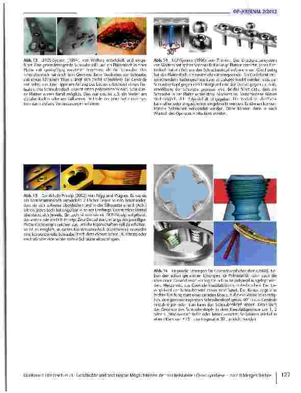 Vorschauseite 4: Geschichte und technische Möglichkeiten der winkelstabilen Osteosynthese - eine Bildergeschichte
