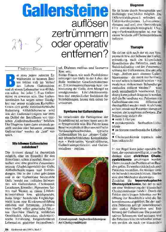 Vorschauseite 1: Gallensteine auflösen, zertrümmern oder operativ entfernen?