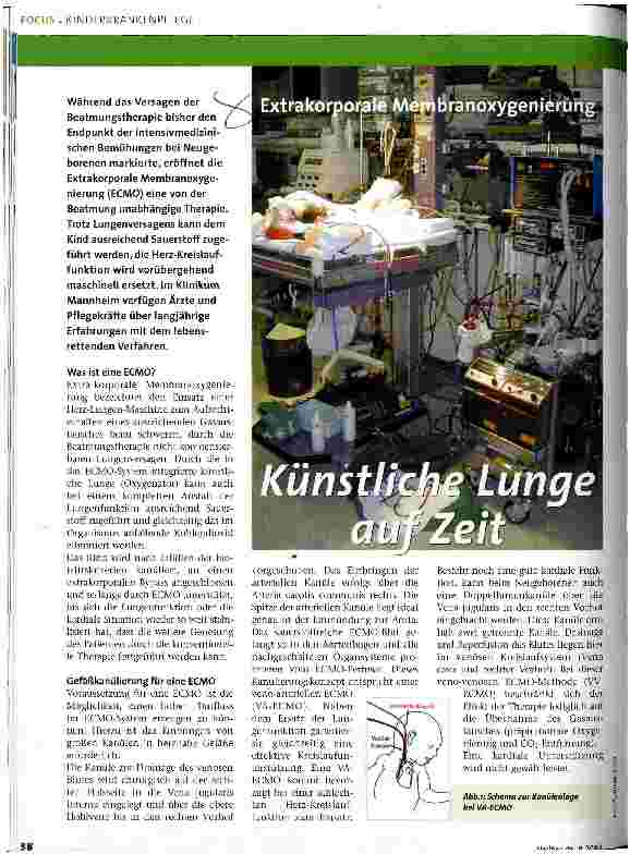Vorschauseite 1: Künstliche Lunge auf Zeit