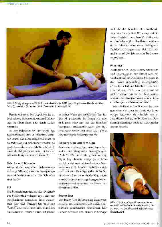 Vorschauseite 3: Das Piriformis-Syndrom