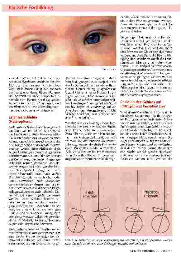 Vorschauseite 2: Verdecktes Schielen - was versteckt sich dahinter?