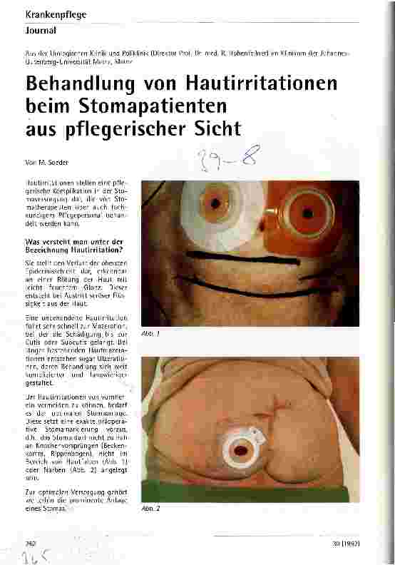 Vorschauseite 1: Behandlung von Hautirritationen beim Stomapatienten aus Pflegerischer Sicht