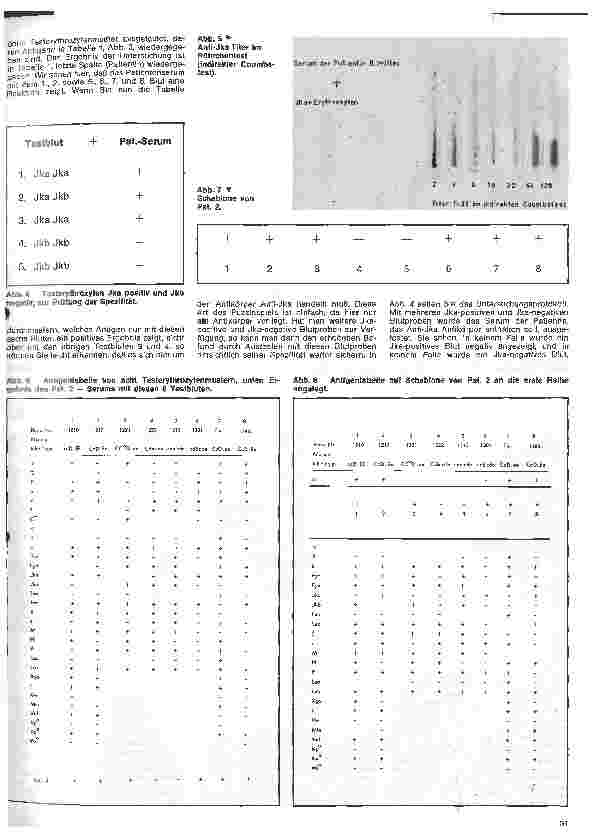 Vorschauseite 2: Transfusionskunde, Blutgruppenserologie und Immunhämatologie 18. Folge: Antikörperdifferenzierung