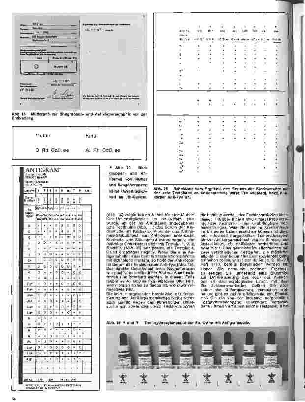 Vorschauseite 5: Transfusionskunde, Blutgruppenserologie und Immunhämatologie 18. Folge: Antikörperdifferenzierung