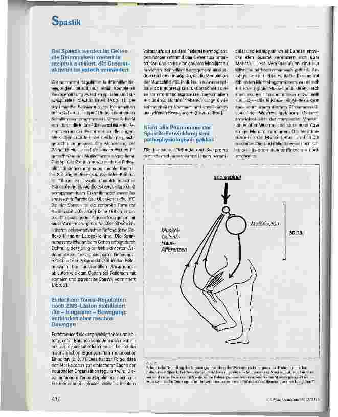 Vorschauseite 3: Grundlagen der Physiotherapie bei spastischer Bewegungsstörung