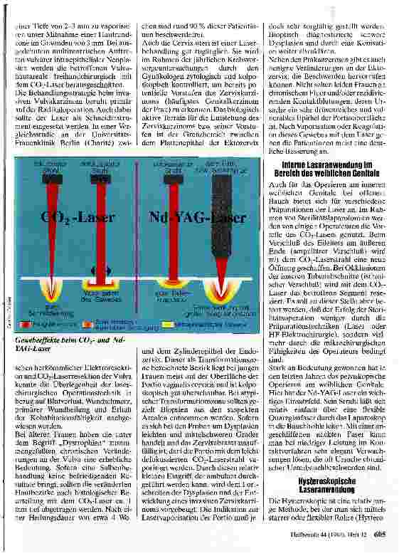 Vorschauseite 4: Laseranwendung in der Gynäkologie