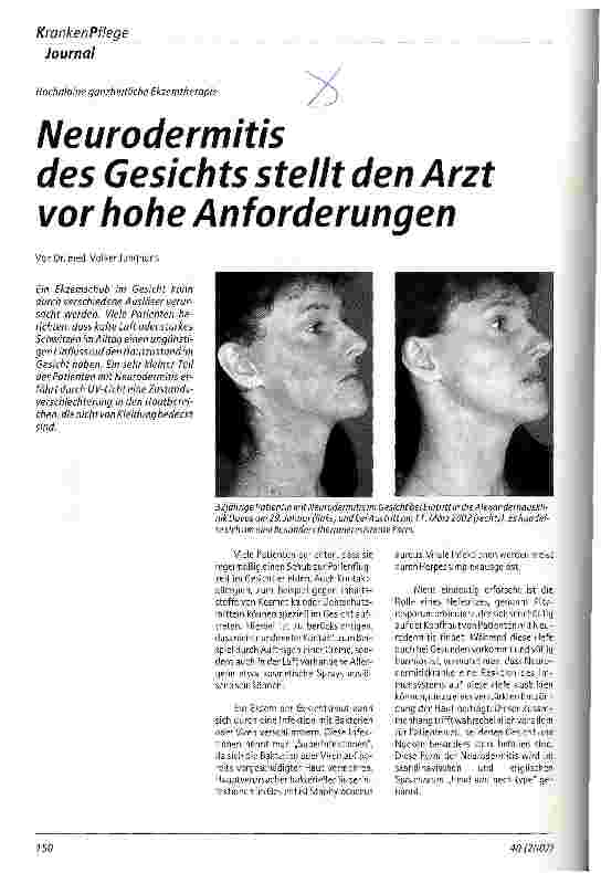 Vorschauseite 1: Neurodermitis des Gesichts stellt den Arzt vor hohe Anforderungen Hochalpine ganzheitliche Ekzemtherapie