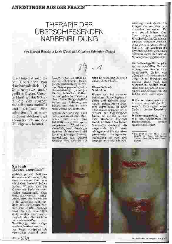 Vorschauseite 1: Therapie der überschießenden Narbenbildung