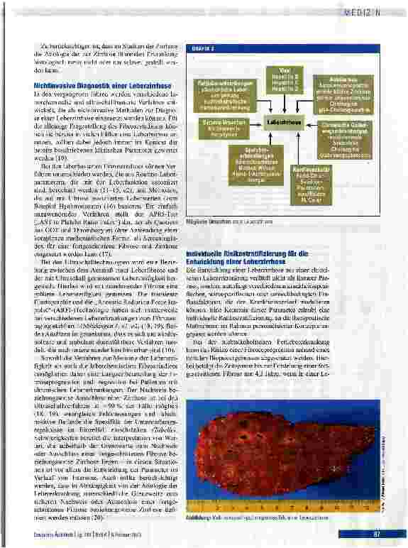 Vorschauseite 3: Ätiologie, Diagnose und Prävention einer Leberzirrhose Teil 1 der Serie zur Leberzirrhose
