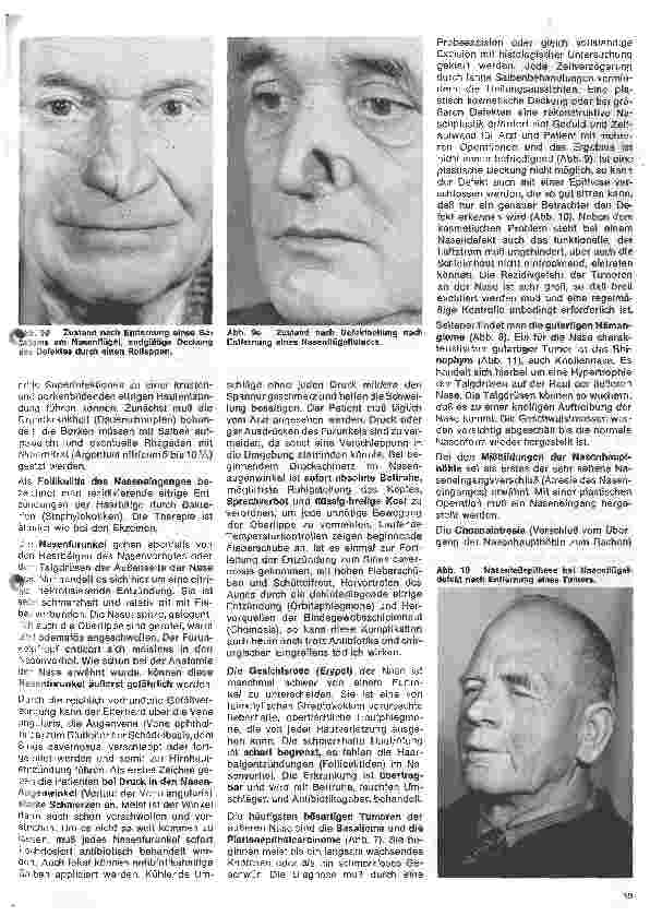 Vorschauseite 4: Einführung in die Hals - Nasen - Ohren - Heilkunde 8. Folge: Die Nase Erkrankungen der äußeren Nase und der Nasenhaupthöhle