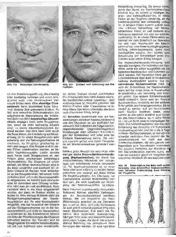Vorschauseite 5: Einführung in die Hals - Nasen - Ohren - Heilkunde 8. Folge: Die Nase Erkrankungen der äußeren Nase und der Nasenhaupthöhle