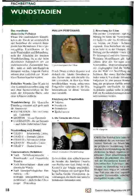 Vorschauseite 2: Diabetisches Fuss-Syndrom