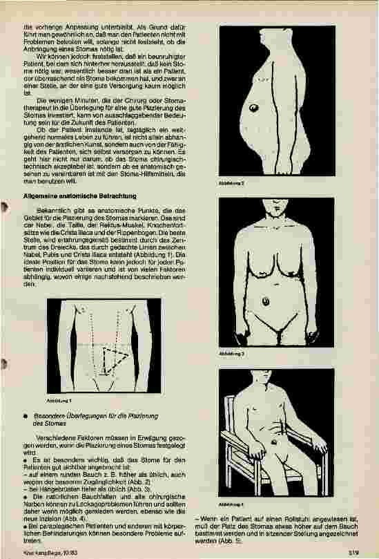 Vorschauseite 2: Individuelle Bestimmung der Plazierung des Stomas unabdingliche Notwendigkeit