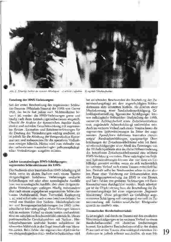 Vorschauseite 2: Halswirbelsäulen-Verletzungen und ihre Behandlung