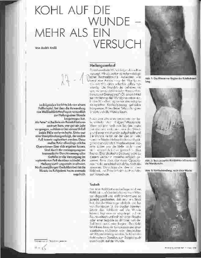 Vorschauseite 1: Kohl auf die Wunde - mehr als ein Versuch
