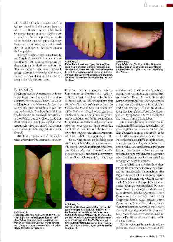 Vorschauseite 2: Diagnostik und Therapie des Lymphödems