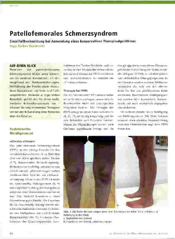 Vorschauseite 1: Patellofemorales Schmerzsyndrom