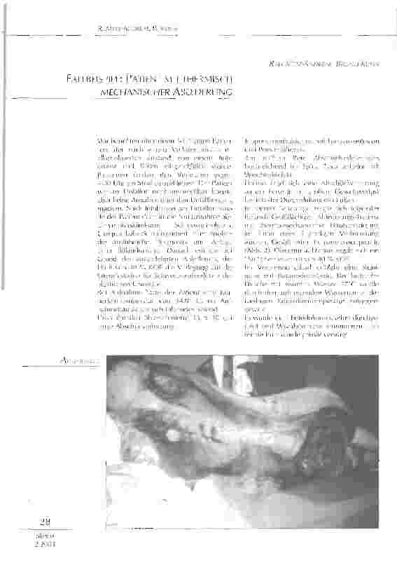Vorschauseite 1: Fallbeispiel: Patient mit thermisch mechanischer Ablederung