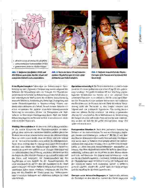 Vorschauseite 2: Physiotherapie in der Kinderkardiologie Herausforderung Herzfehler