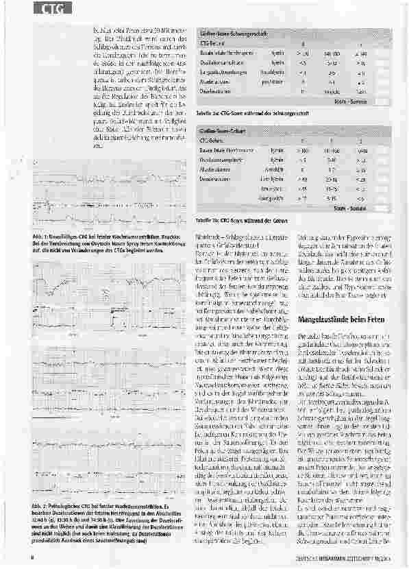 Vorschauseite 3: Das CTG richtig interpretieren