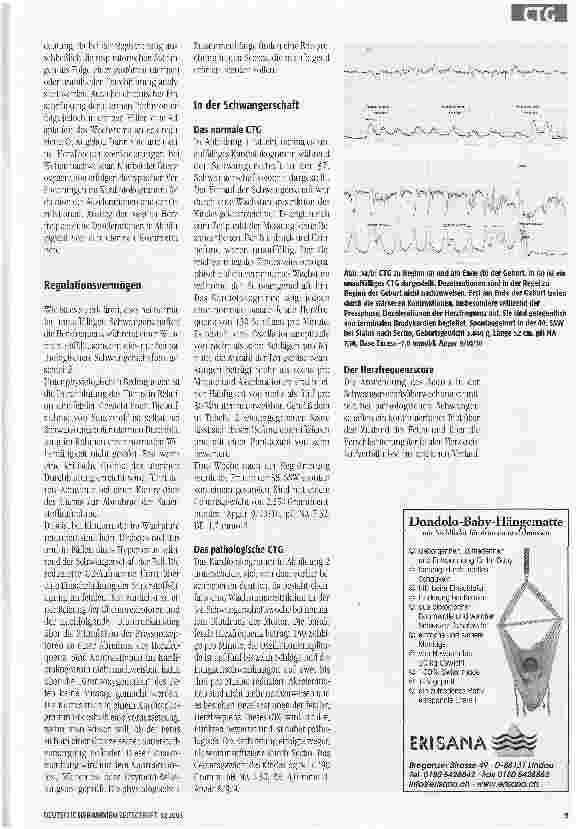 Vorschauseite 4: Das CTG richtig interpretieren