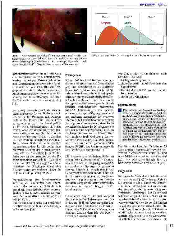 Vorschauseite 2: Frozen Shoulder - Ätiologie, Diagnostik und Therapie