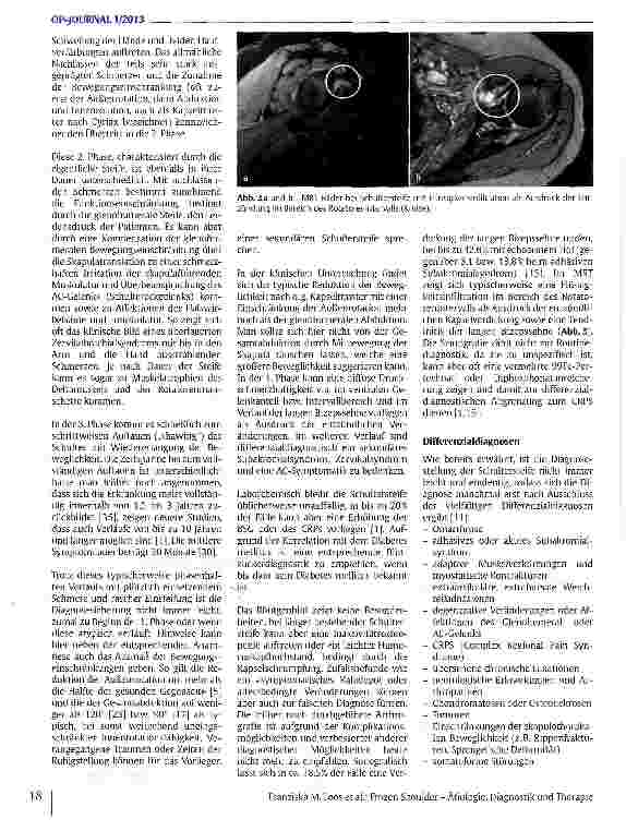 Vorschauseite 3: Frozen Shoulder - Ätiologie, Diagnostik und Therapie