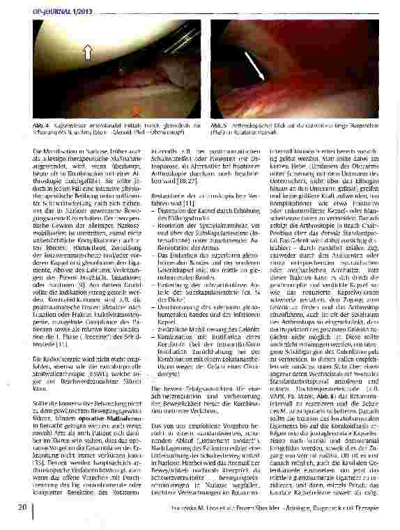 Vorschauseite 5: Frozen Shoulder - Ätiologie, Diagnostik und Therapie